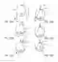 Fig. 23 - MINIMALLY INVASIVE TISSUE SUPPORT