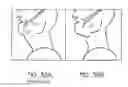 Fig. 25 - MINIMALLY INVASIVE TISSUE SUPPORT