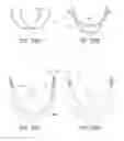 Fig. 27 - MINIMALLY INVASIVE TISSUE SUPPORT