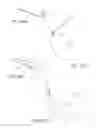 Fig. 29 - MINIMALLY INVASIVE TISSUE SUPPORT