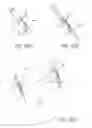 Fig. 32 - MINIMALLY INVASIVE TISSUE SUPPORT