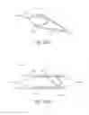 Fig. 39 - MINIMALLY INVASIVE TISSUE SUPPORT