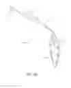 Fig. 51 - MINIMALLY INVASIVE TISSUE SUPPORT