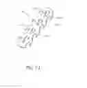 Fig. 63 - MINIMALLY INVASIVE TISSUE SUPPORT