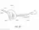 Fig. 71 - MINIMALLY INVASIVE TISSUE SUPPORT
