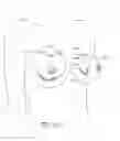 Fig. 72 - MINIMALLY INVASIVE TISSUE SUPPORT