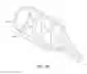 Fig. 75 - MINIMALLY INVASIVE TISSUE SUPPORT