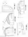 Fig. 131 - Patient-adapted and improved articular implants, designs and related guide tools