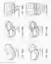 Fig. 197 - Patient-adapted and improved articular implants, designs and related guide tools