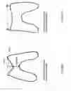 Fig. 34 - Patient-adapted and improved articular implants, designs and related guide tools