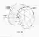 Fig. 49 - Patient-adapted and improved articular implants, designs and related guide tools