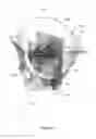 Fig. 03 - DETERMINING A PLANE OF AN ANATOMICAL BODY PART