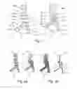 Fig. 02 - Method for visualizing and quantifying the changes in an organic or non-organic structure in the human body