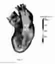 Fig. 06 - Physically-constrained modeling of a heart in medical imaging