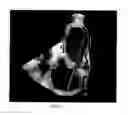 Fig. 07 - Physically-constrained modeling of a heart in medical imaging