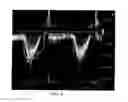 Fig. 08 - Physically-constrained modeling of a heart in medical imaging