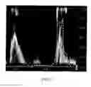 Fig. 09 - Physically-constrained modeling of a heart in medical imaging