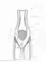 Fig. 01 - Sportswear to aid in pelvis support