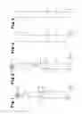 Fig. 02 - Electric toothbrush