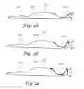 Fig. 09 - Set of podiatric articles