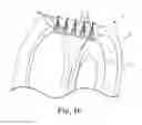 Fig. 06 - Washing machine brush system and method