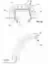 Fig. 03 - Process for manufacturing a part made of composite material that comprises at least one radius of curvature
