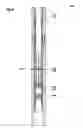 Fig. 07 - Restricted axial movement locking mechanism