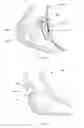 Fig. 14 - Garment hanger