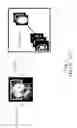 Fig. 03 - Method and apparatus for acquiring magnetic resonance imaging signals