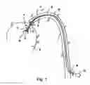 Fig. 02 - Compressible rotor for a fluid pump