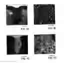 Fig. 02 - Mesenchymal stem cell and a method of use thereof