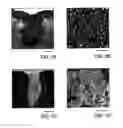 Fig. 02 - MESENCHYMAL STEM CELL AND THE METHOD OF USE THEREOF