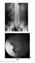 Fig. 02 - ENTERICALLY COATED CYSTEAMINE, CYSTAMINE AND DERIVATIVES THEREOF