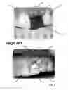 Fig. 04 - Techniques for providing custom-formed implants