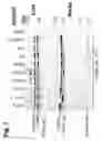 Fig. 08 - Chimeric PCSK9 proteins, cells comprising same, and assays using same