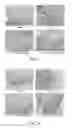 Fig. 07 - Method for inhibiting activation of macrophages
