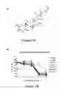 Fig. 02 - TREATMENT OF HUMAN OSTEOSARCOMA