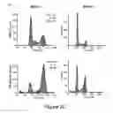 Fig. 05 - TREATMENT OF HUMAN OSTEOSARCOMA