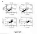 Fig. 06 - TREATMENT OF HUMAN OSTEOSARCOMA