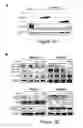 Fig. 07 - TREATMENT OF HUMAN OSTEOSARCOMA