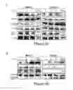 Fig. 08 - TREATMENT OF HUMAN OSTEOSARCOMA