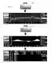 Fig. 09 - Apparatus for acquiring, processing and transmitting physiological sounds