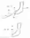 Fig. 07 - FOOT ORTHOSIS SUPPORT DEVICE METHOD AND APPARATUS