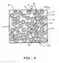 Fig. 09 - Method for assessing a patients fluid status and/or sensitivity to fluid removal, controller, and devices