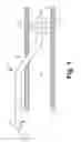 Fig. 02 - SLEEVE VALVE CATHETERS