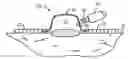 Fig. 01 - Shape and Pressure Adjustable Dressing For Blisters and Puncture Wounds