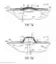 Fig. 09 - Shape and Pressure Adjustable Dressing For Blisters and Puncture Wounds