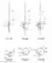 Fig. 05 - Selectively expandable operative element support structure and methods of use