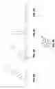 Fig. 09 - Ablation catheter with flexible tip