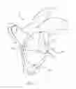 Fig. 03 - Combination reamer/drill bit for shoulder arthoplasty